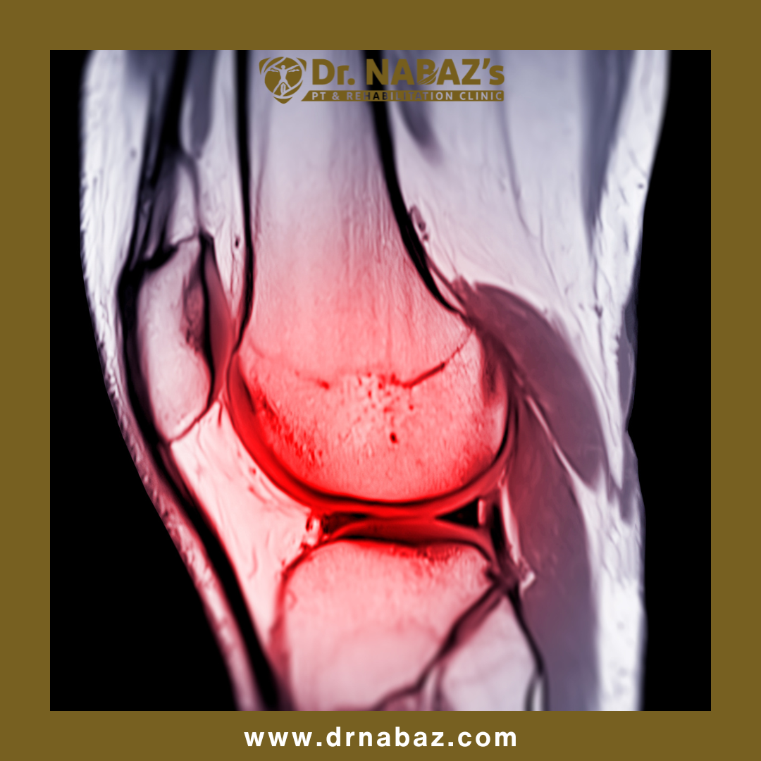 <a href='https://www.drnabaz.com/services/review/4' class='text-info'  >Orthopedic Physiotherapy</a>